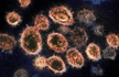No foreign strain of Covid-19 found in Amravati, Yavatmal: Maharashtra govt